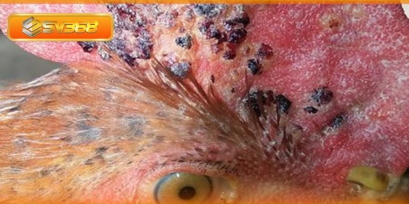Khó thở là triệu chứng bệnh đậu gà phổ biến