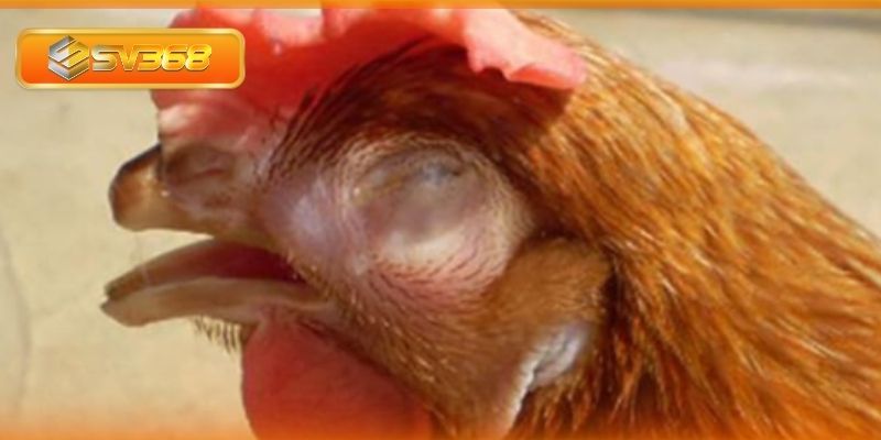Những nguyên nhân gây bệnh về đường hô hấp mãn tính